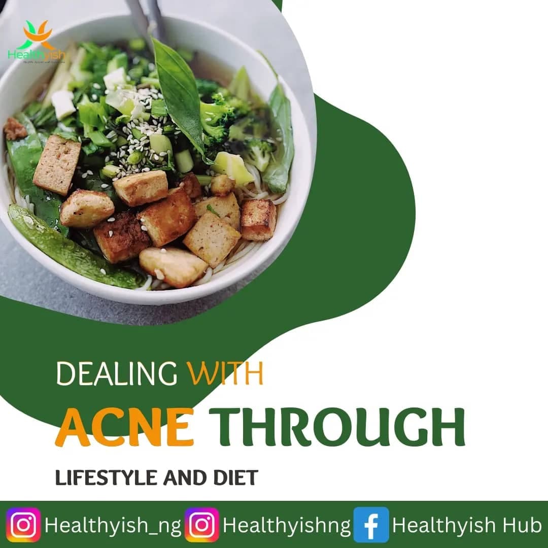 DEALING WITH ACNE THROUGH LIFESTYLE AND DIET